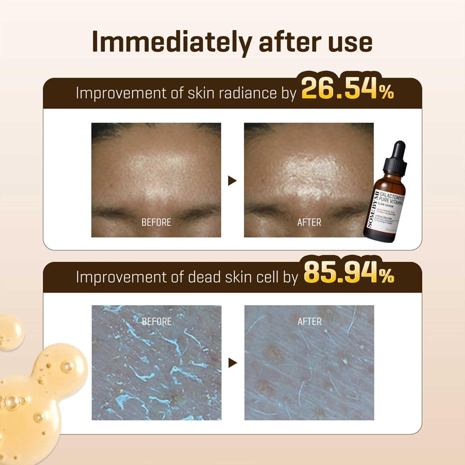 Some By MI GALACTOMYCES PURE VITAMIN C GLOW SERUM 30ml