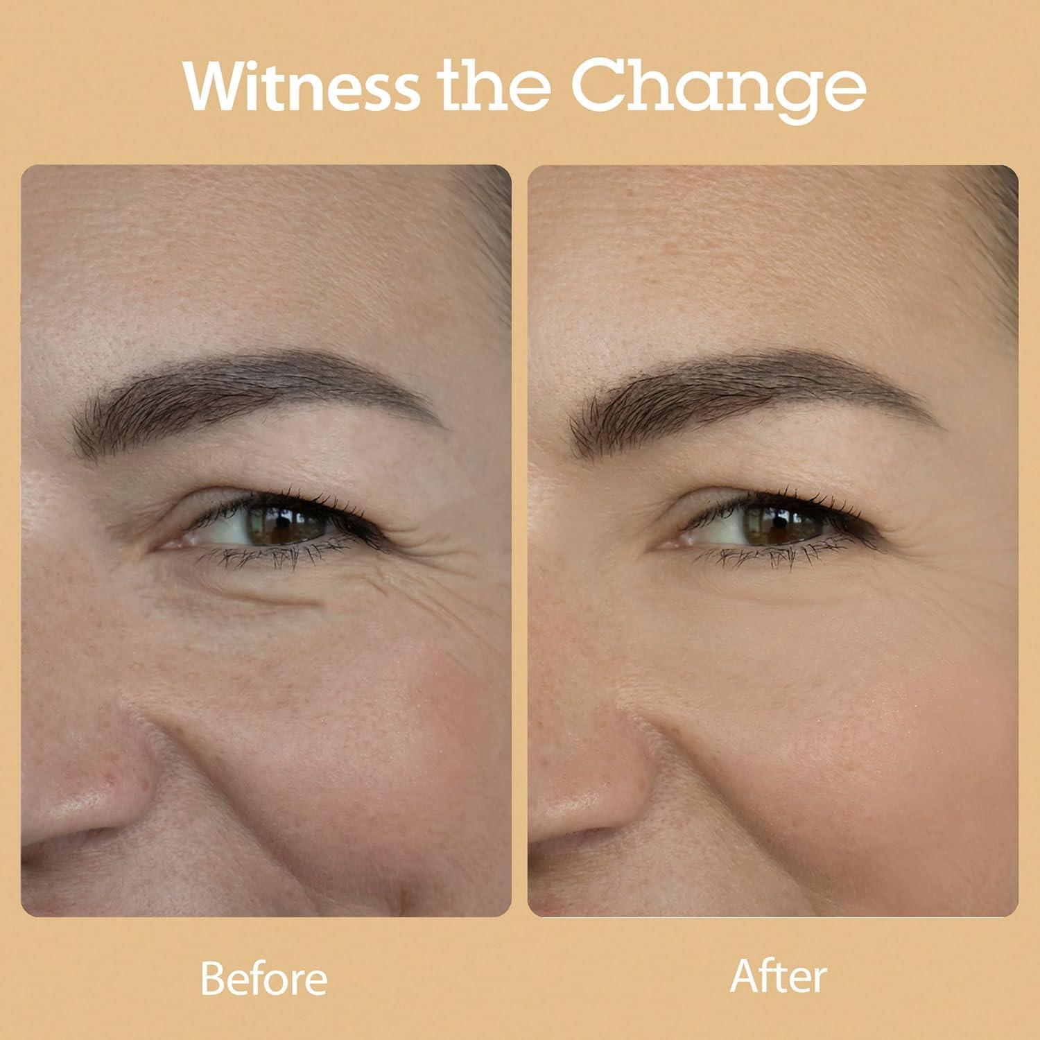 Blithe Vital Treatment 8 Nourishing Beans essence, formula for targeted skin concerns