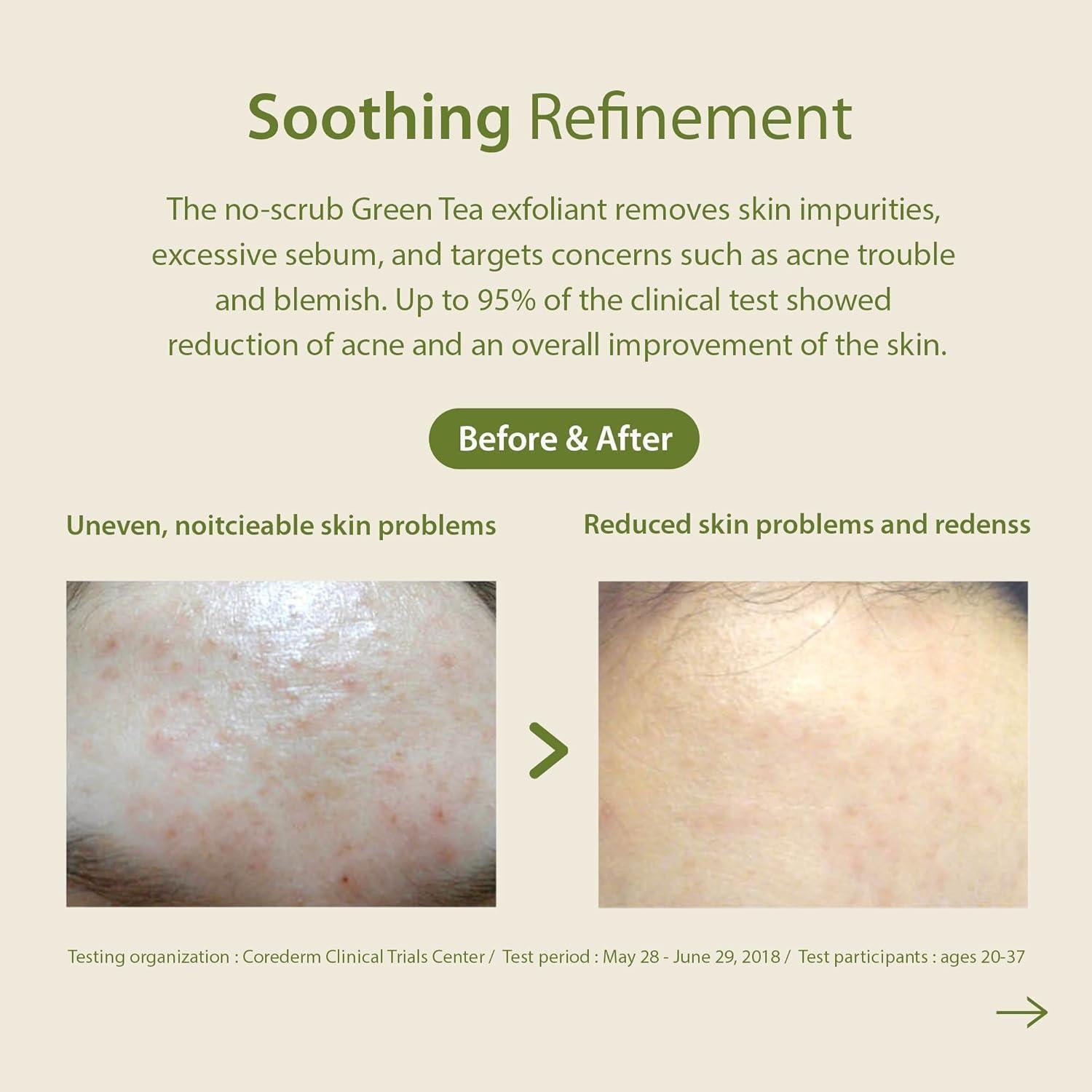 Blithe Patting Splash Mask Green Tea, Korean skincare product in 150ml size