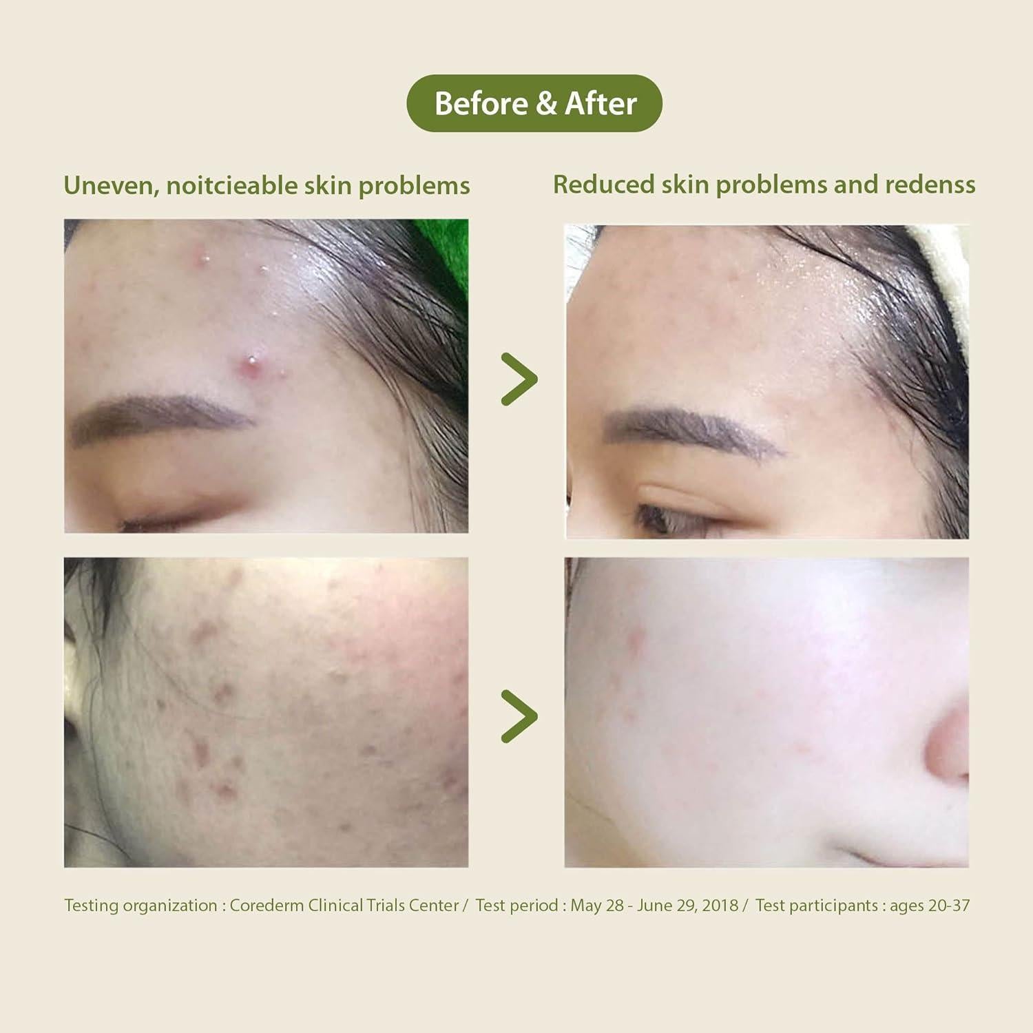 Blithe Patting Splash Mask Green Tea, daily skincare routine essential