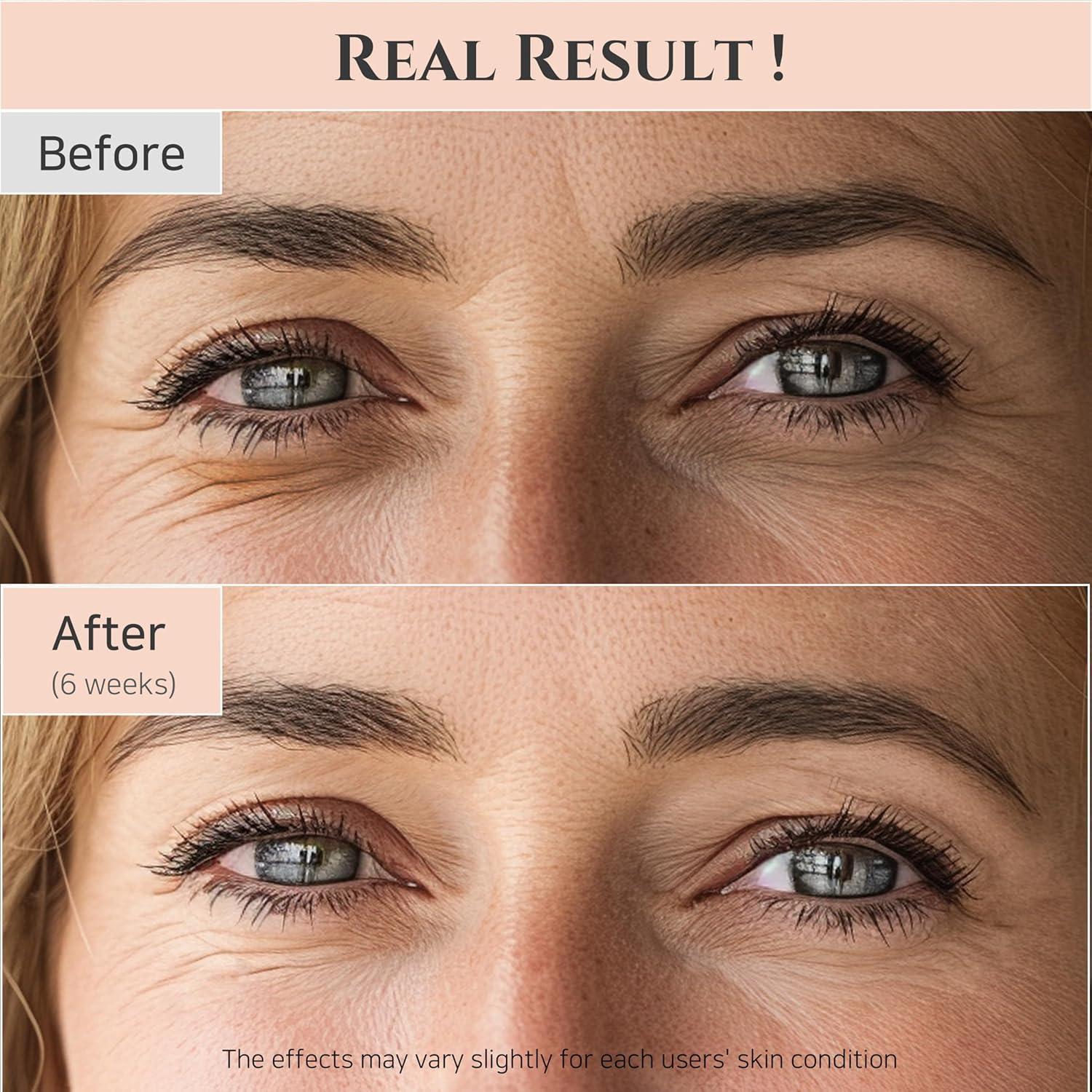 Beauty of Joseon Revive Eye Serum 30ml product view 8