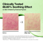 Anua  Azelaic 10 Hyaluron Redness Soothing Pad 230ml