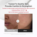 Medicube Relief Cream dermatologically tested sensitive skin
