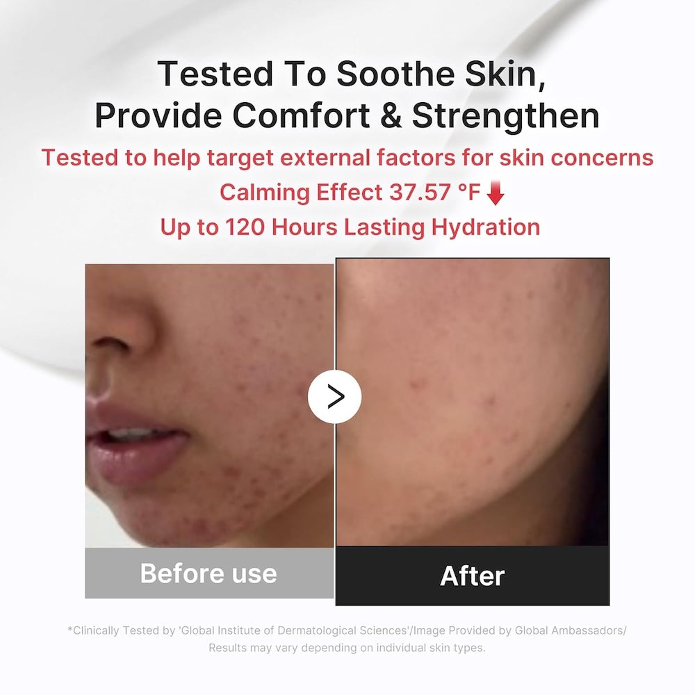 Medicube Relief Cream dermatologically tested sensitive skin