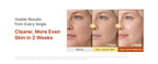 SUNGBOON EDITOR Kojic Acid Niacinamide Brightening Capsule Cream