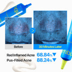 Numbuzin Zero Blemish 3X Spot Correcting Cream 20ml