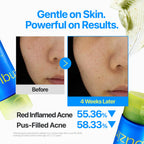 Numbuzin Zero Blemish Clarifying 2% Sulfur Cleansing Foam 150ml