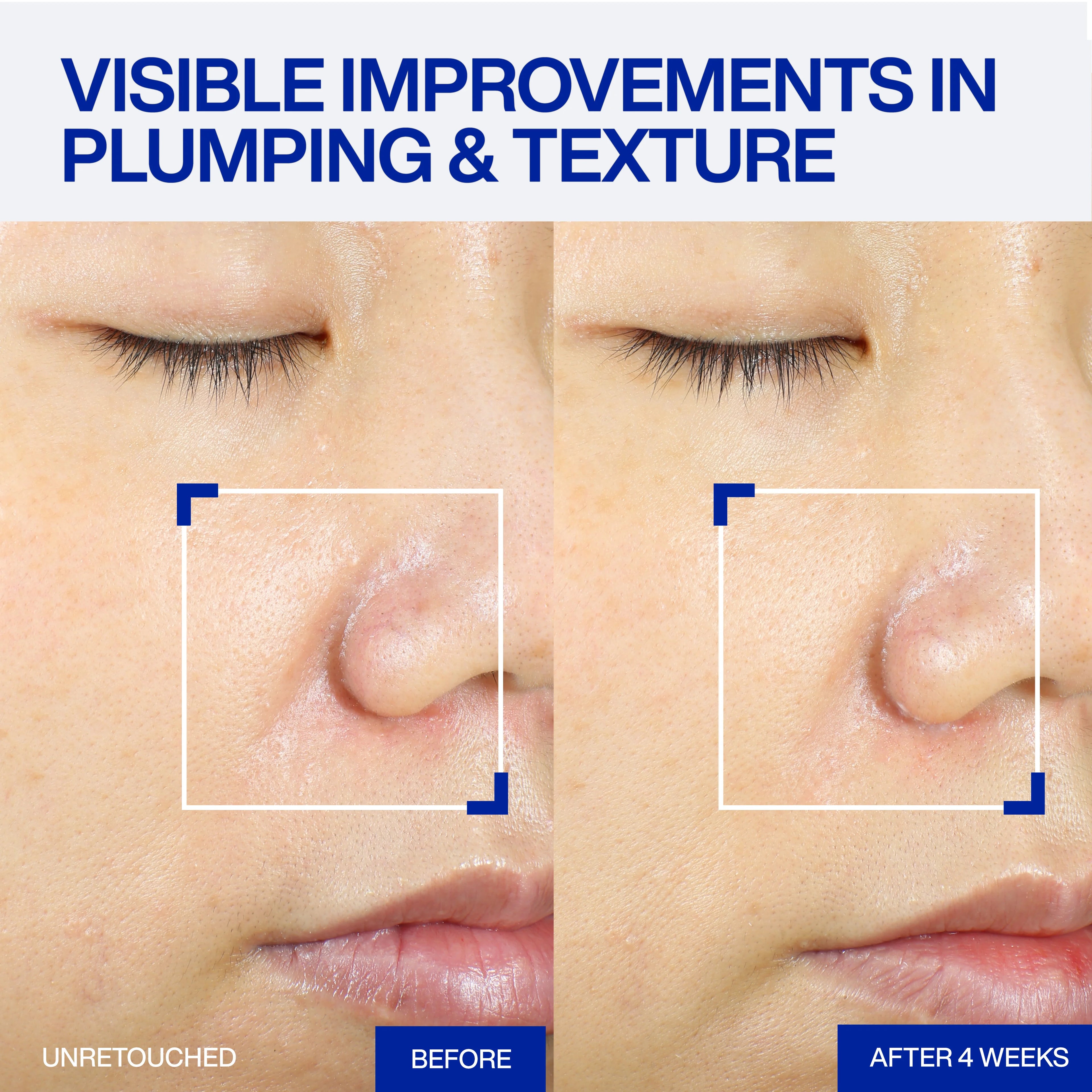 IOPE XMD STEMⅢ Clinical Recover Serum 50ml