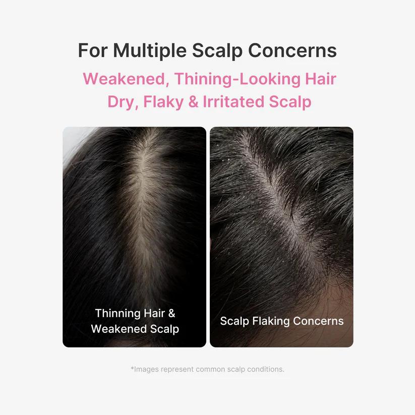 Medicube Rosemary Scalp Serum thicker fuller-looking hair from roots