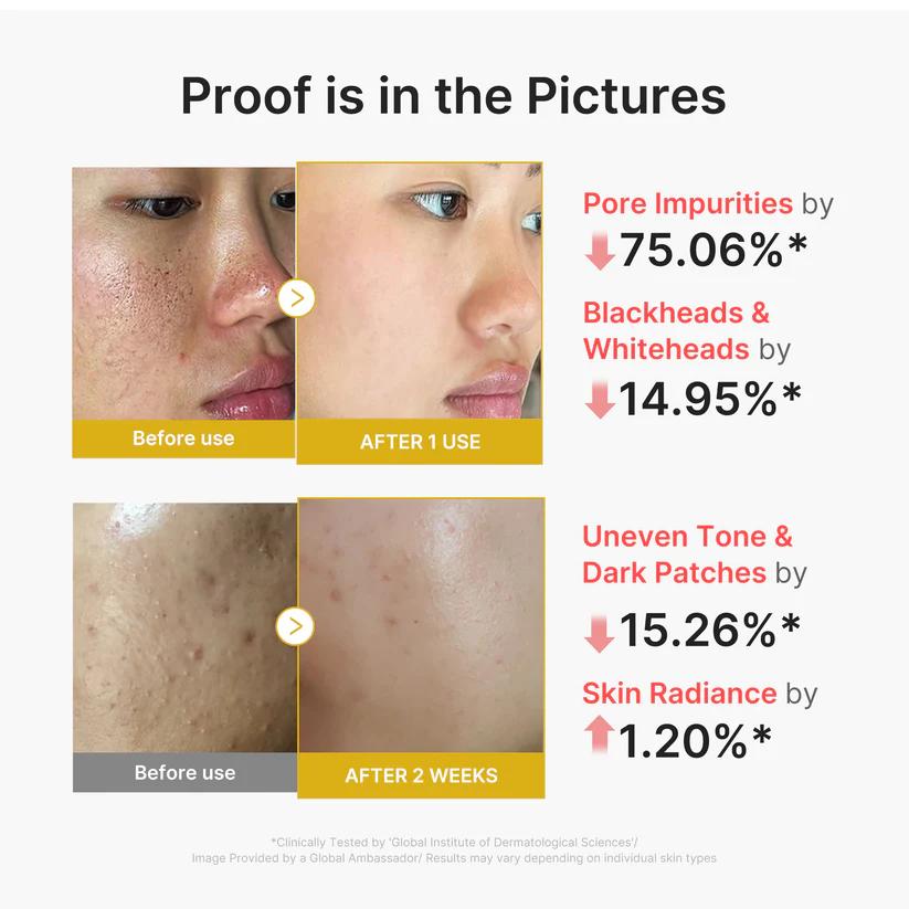 Medicube Kojic Acid Turmeric Peel Shot pore-clearing formula